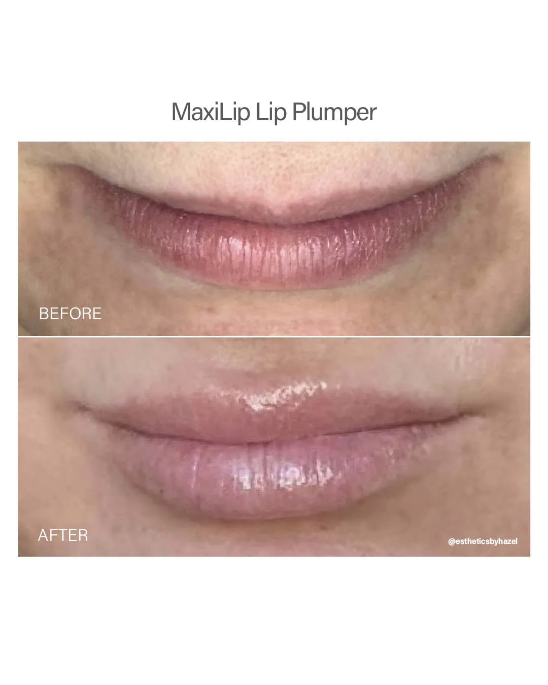 Maxilip Lip Plumper