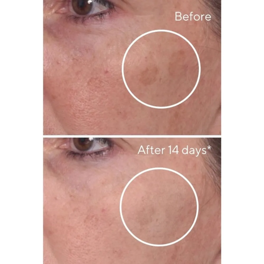 Murad Rapid Dark Spot Correcting Serum